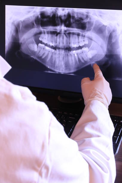 Best Emergency Treatment for Dental Infections or Abscesses in Indian Springs Village, AL